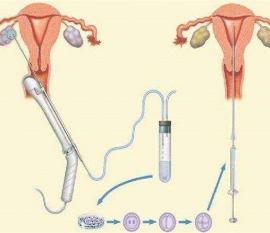 35岁女性备孕请做好以下检查，“健康广州代生宝宝”跑不远